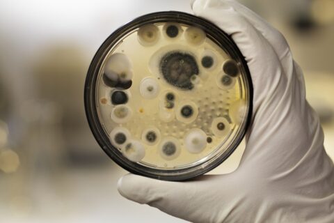 Mildew culture on agar plate